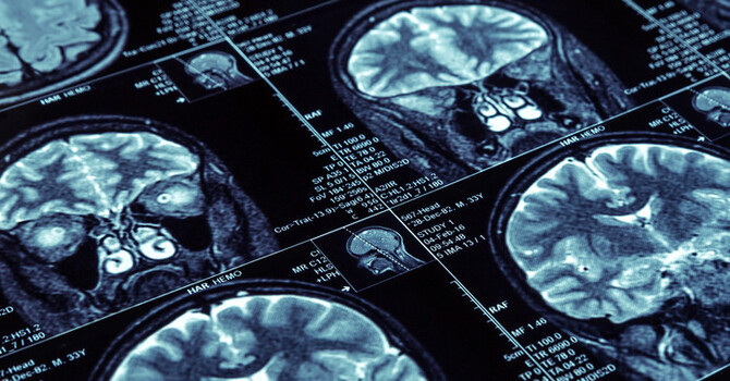 Are You Losing Your Mind? image