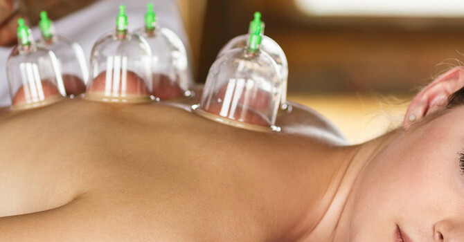 How Cupping Works image