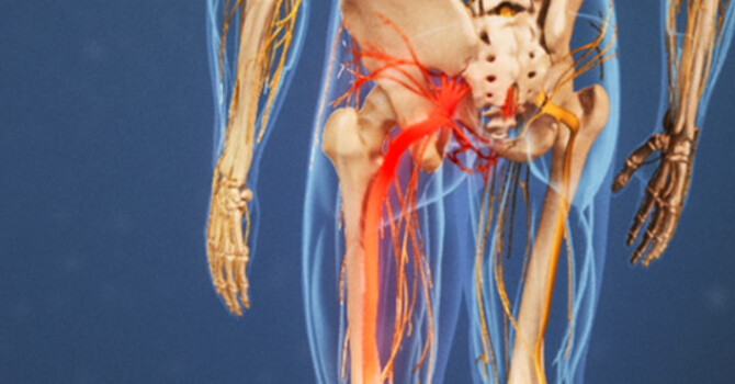 Sciatica-Ask The Experts Part II image