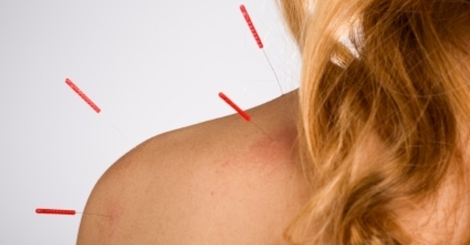 Acupuncture for Rotator Cuff Injuries